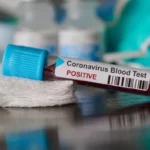 Satu Pejabat Pemprov Sultra Positif Covid-19