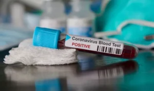 Satu Pejabat Pemprov Sultra Positif Covid-19